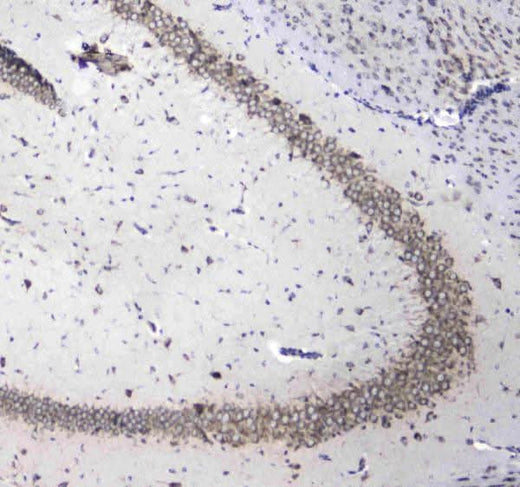 Anti-L1CAM Antibody Boster Bio