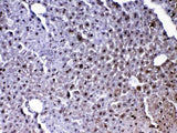 Anti-PARK7/DJ1 Antibody Picoband® Boster Bio