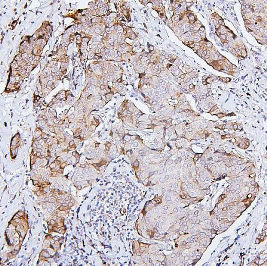Anti-PKC delta/PRKCD Antibody Picoband® Boster Bio