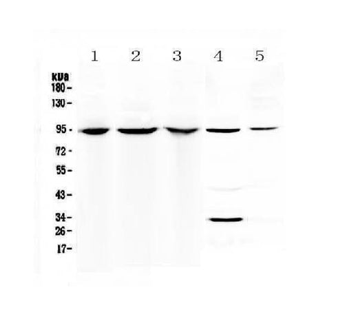 Anti-Complement C7 Antibody Picoband® Boster Bio