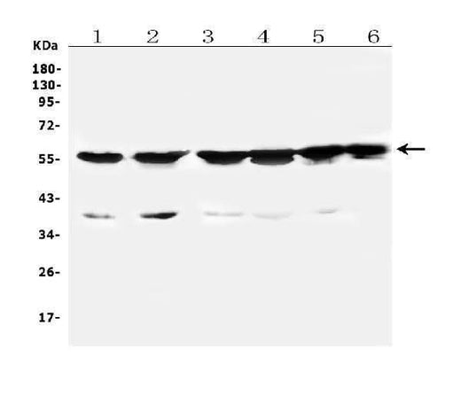 Anti-Cytochrome P450 2B6/CYP2B6 Antibody Picoband® Boster Bio