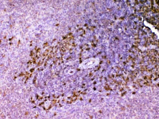 Anti-ADA Antibody Picoband® Boster Bio