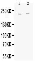 Anti-MRP1/ABCC1 Antibody Picoband® Boster Bio