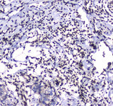 Anti-GFI1 Antibody Boster Bio