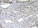 Anti-VEGF Receptor 2/KDR Antibody Picoband® Boster Bio