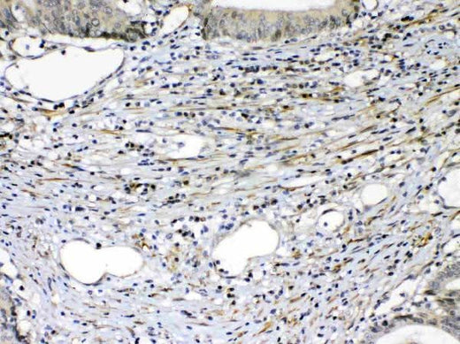 Anti-VEGF Receptor 2/KDR Antibody Picoband® Boster Bio