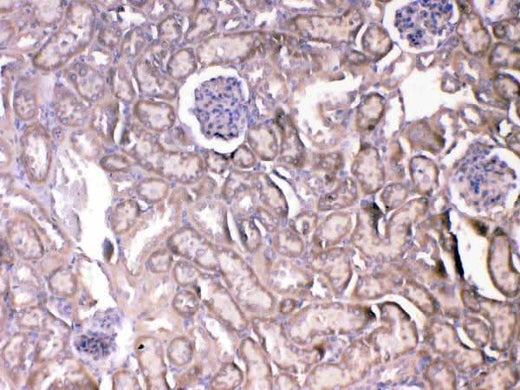 Anti-VEGF Receptor 2/Kdr Antibody Picoband® Boster Bio