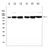Anti-MCK10/NEP/DDR1 Antibody Picoband® Boster Bio