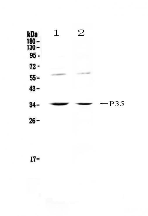 Anti-IL12A Antibody Picoband® Boster Bio