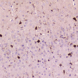 Anti-Cystatin C/CST3 Antibody Picoband® Boster Bio