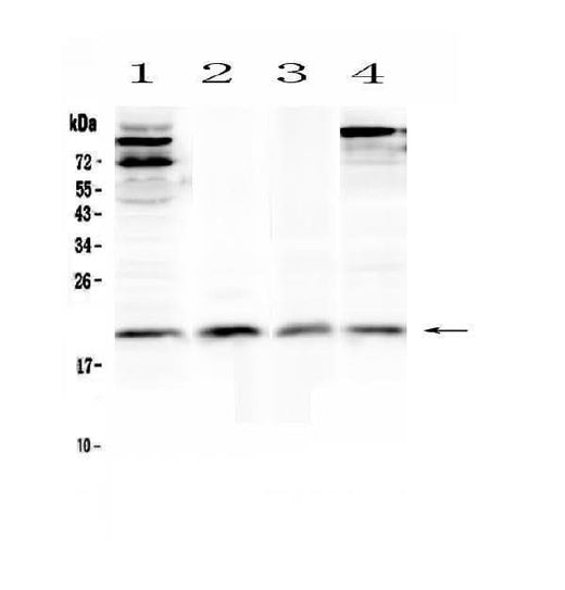 Anti-IL22 Antibody Picoband® Boster Bio