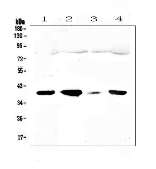Anti-uPA Receptor/PLAUR Antibody Picoband® Boster Bio