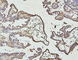 Anti-IRAK-1/IRAK1 Antibody Picoband® Boster Bio