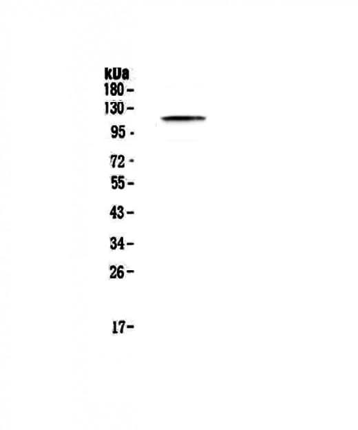 Anti-PMS2 Antibody Picoband® Boster Bio