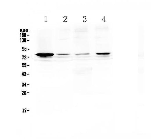 Anti-RANK/TNFRSF11A Antibody Picoband® Boster Bio