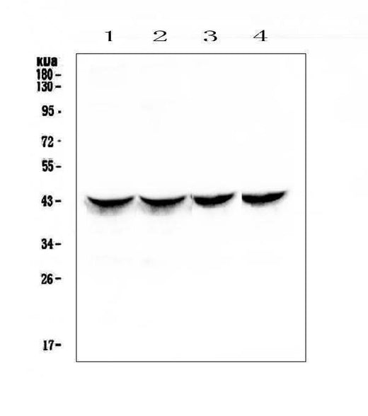 Anti-Cardiac Troponin T/TNNT2 Antibody Picoband® Boster Bio