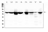Anti-Lamin B Receptor/LBR Antibody Picoband® Boster Bio