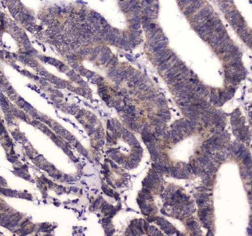Anti-BRD7 Antibody Picoband® Boster Bio