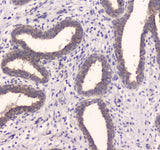 Anti-Insulin degrading enzyme/IDE Antibody Picoband® Boster Bio