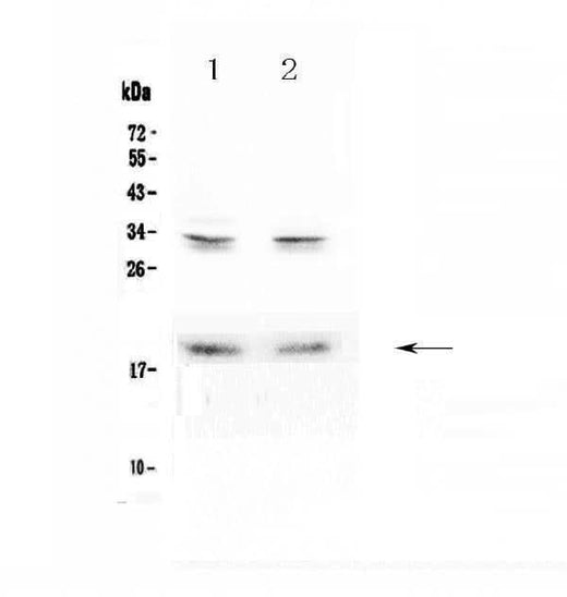 Anti-Pleiotrophin/PTN Antibody Picoband® Boster Bio