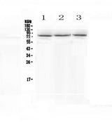 Anti-epithelial Sodium Channel alpha/SCNN1A Antibody Picoband® Boster Bio