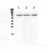 Anti-epithelial Sodium Channel alpha/SCNN1A Antibody Picoband® Boster Bio