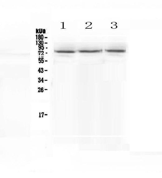 Anti-epithelial Sodium Channel alpha/SCNN1A Antibody Picoband® Boster Bio