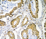 Anti-PRMT1 Antibody Picoband® Boster Bio