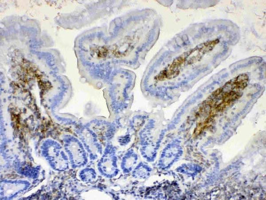 Anti-Lyn Antibody Picoband® Boster Bio