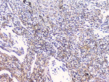 Anti-FCGR2A Antibody Picoband® Boster Bio
