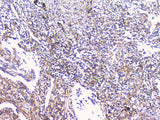 Anti-FCGR2A Antibody Picoband® Boster Bio
