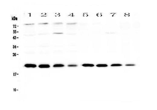 Anti-BNIP3 Antibody Picoband® Boster Bio