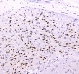 Anti-strogen Related Receptor gamma/ESRRG Antibody Picoband® Boster Bio