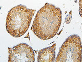 Anti-CRB1 Antibody Picoband® Boster Bio
