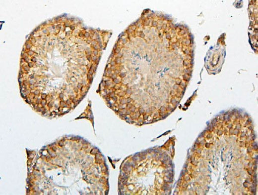Anti-CRB1 Antibody Picoband® Boster Bio