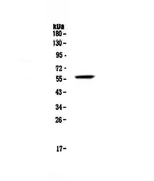 Anti-FGR Antibody Picoband® Boster Bio