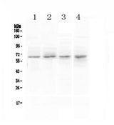 Anti-CCKBR Antibody Picoband® Boster Bio