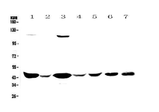 Anti-Creatine kinase B type/CKB Antibody Picoband® Boster Bio