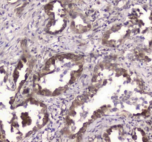 Anti-GLO1 Antibody Picoband® Boster Bio