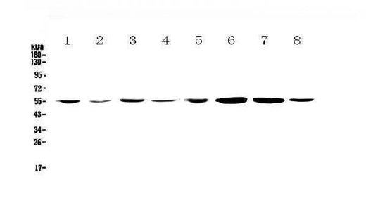 Anti-CCR3 Antibody Picoband® Boster Bio