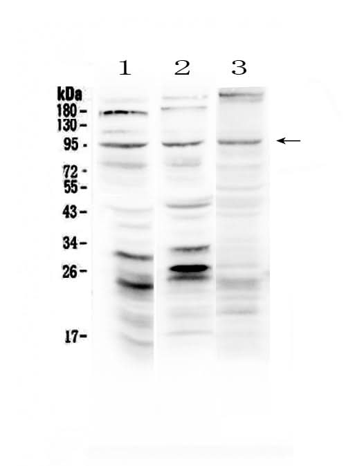 Anti-Semaphorin 3A/SEMA3A Antibody Picoband® Boster Bio