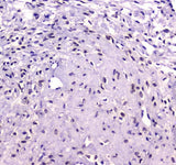 Anti-RUNX1T1/ETO Antibody Picoband® Boster Bio