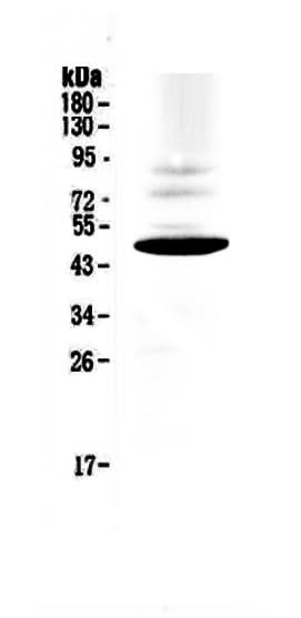 Anti-CCR1 Antibody Picoband® Boster Bio