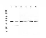 Anti-HGD Antibody Picoband® Boster Bio