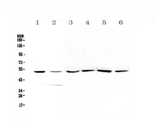 Anti-HGD Antibody Picoband® Boster Bio