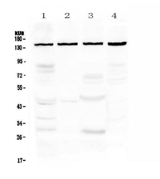 Anti-TRPC4 Antibody Picoband® Boster Bio