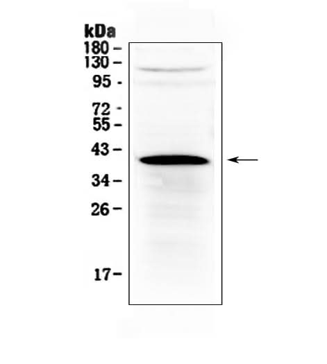 Anti-HSD17B1 Antibody Picoband® Boster Bio