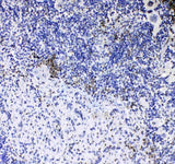 Anti-CD8 alpha/Cd8a Antibody Picoband® Boster Bio