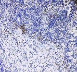 Anti-CD8 alpha/Cd8a Antibody Picoband® Boster Bio