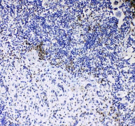 Anti-CD8 alpha/Cd8a Antibody Picoband® Boster Bio